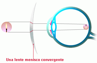 Correccion de vista cansada